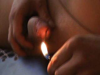 Vagina Burned By Cigarette - Extreme Cigarette Burning Free Sex Videos - Watch Beautiful and Exciting  Extreme Cigarette Burning Porn at anybunny.com